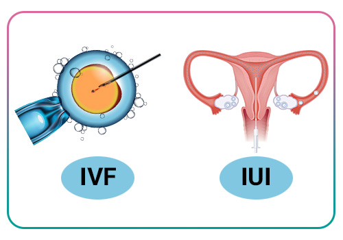 IVF in endometriosis treatment