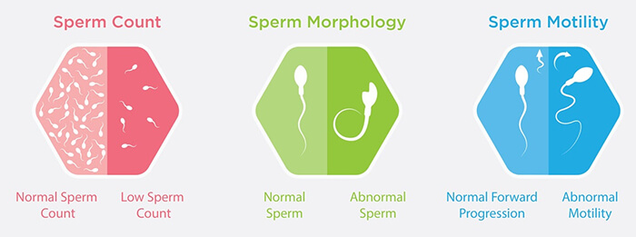 Sperm problems in infertility