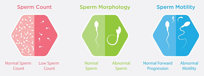 Sperm Problems in Infertility, Male Fertility Problems