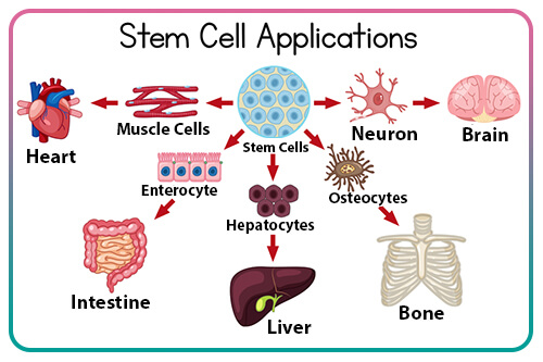 Application of stem cells