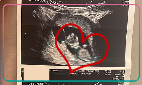 IVF success embryo ultrasound