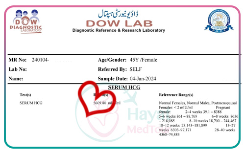 A positive pregnancy test for a remarkable 45-year-old lady who embraced success through IVF in Iran. Witnessing the magic of new beginnings and dreams coming true