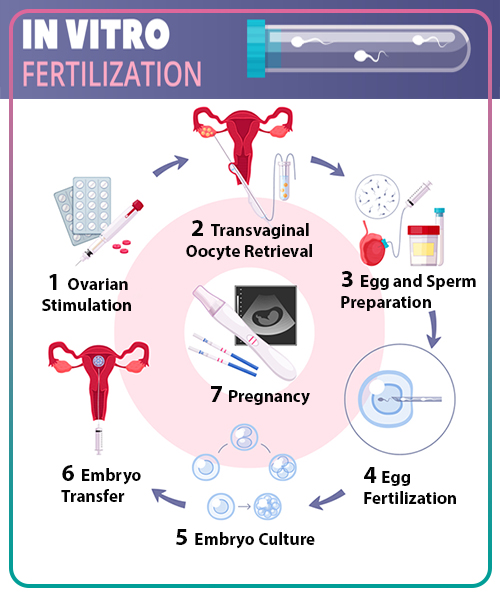 What is in vitro fertilization (IVF)