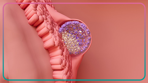 ما هي العوامل التي تؤدي إلى توقف نمو بعض الأجنة في عملية أطفال الأنابيب؟