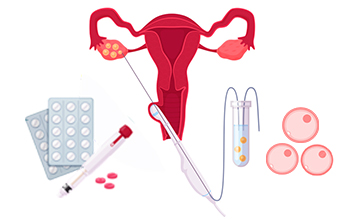 Egg Retrieval Process