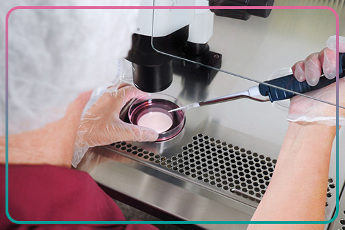 Egg collection in IVF