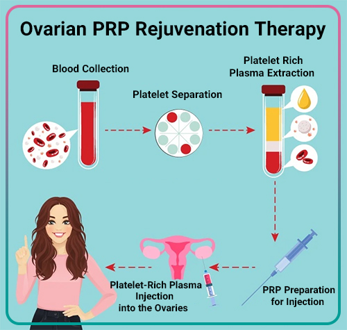 Ovarian PRP Rejuvenation Therapy