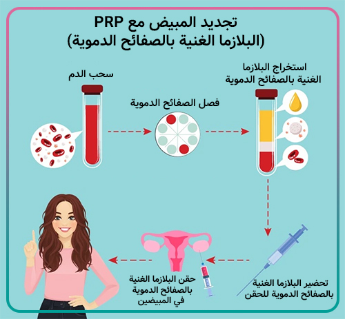 تجديد المبيض مع PRP (البلازما الغنية بالصفائح الدموية)