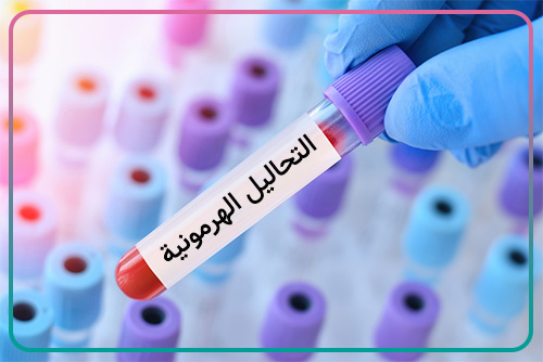 التحاليل الهرمونية وتحاليل الخصوبة للنساء